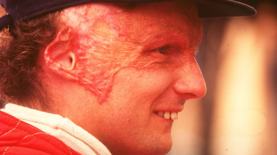 Niki Lauda - Joe Monster