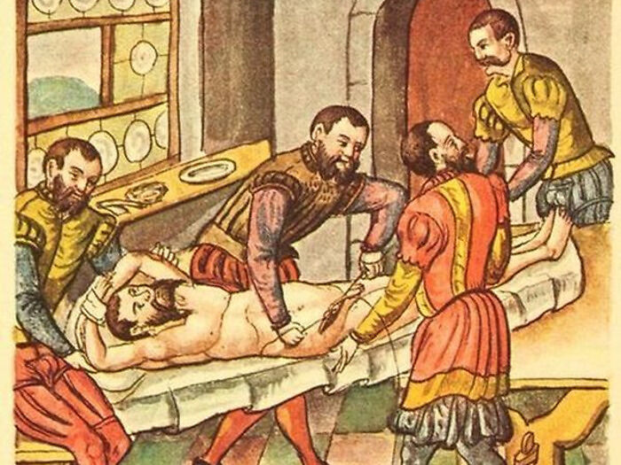 W 1559 roku niemiecki cyrulik i chirurg Gaspar Stromayr opublikował podręcznik medyczny „Practica copiosa”, w którym opisał kastrację pacjenta w celu wyleczenia...