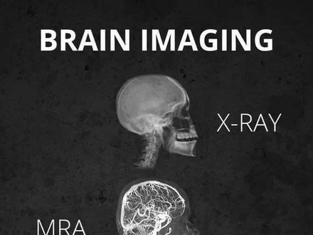 Różne sposoby obrazowania mózgu