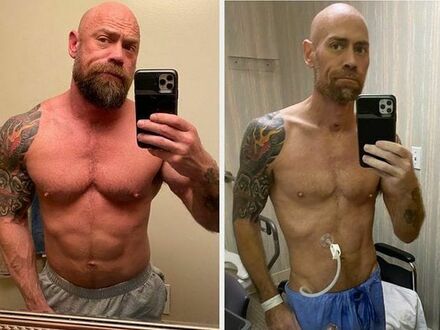 Jak wyglądał Mike Schultz po walce z COVID-19, przez 6 tygodni był w szpitalu