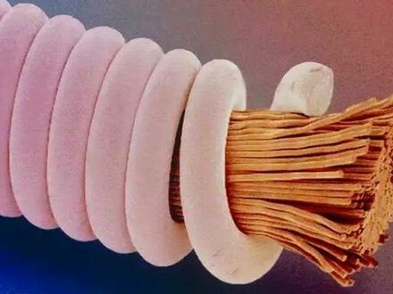 Zdjęcie mikroskopowe struny od gitary