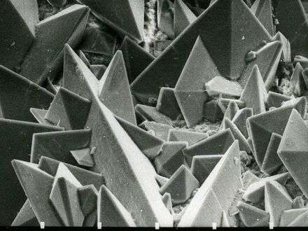 Kamień nerkowy pod mikroskopem elektronowym