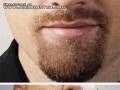 Sposób na równą brodę
