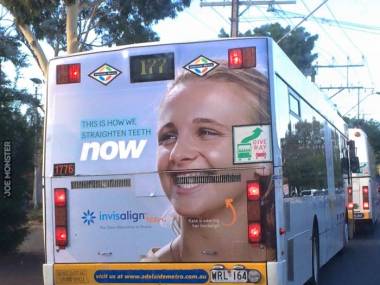 Co znaczy fatalnie umiejscowiona reklama niewidzialnego aparatu na zęby