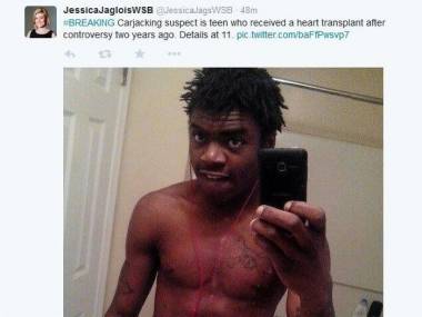 Wrzuciła zdjęcie czarnoskórego podejrzanego bez koszulki, po transplantacji serca i zaczęły się oskarżenia o rasizm
