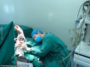 Zdjęcie chirurga Luo Shanpenga padniętego z wyczerpania po przeprowadzeniu szóstej i ostatniej operacji z rzędu bez żadnej przerwy. Cała 6 pacjentów została uratowana